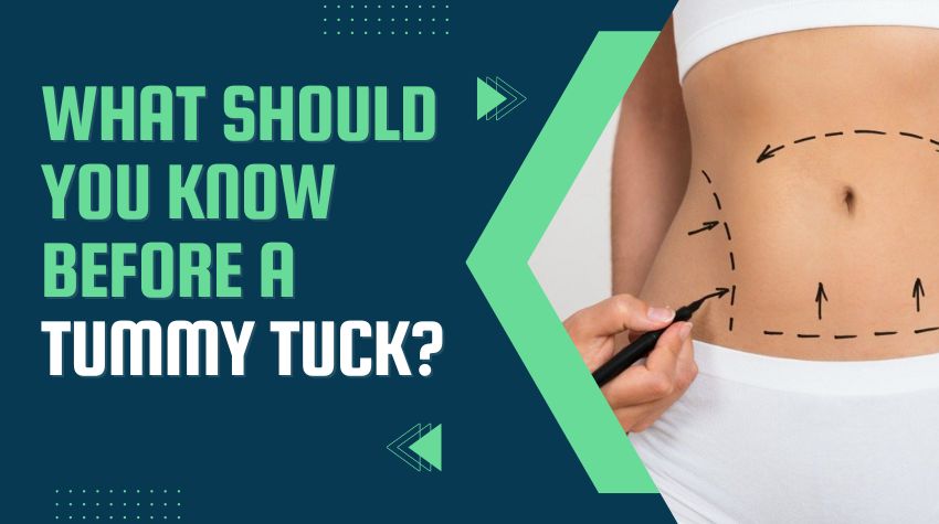 What should You Know Before A Tummy Tuck?