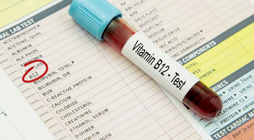 Is Vitamin B 12 Test Required for Anemia?