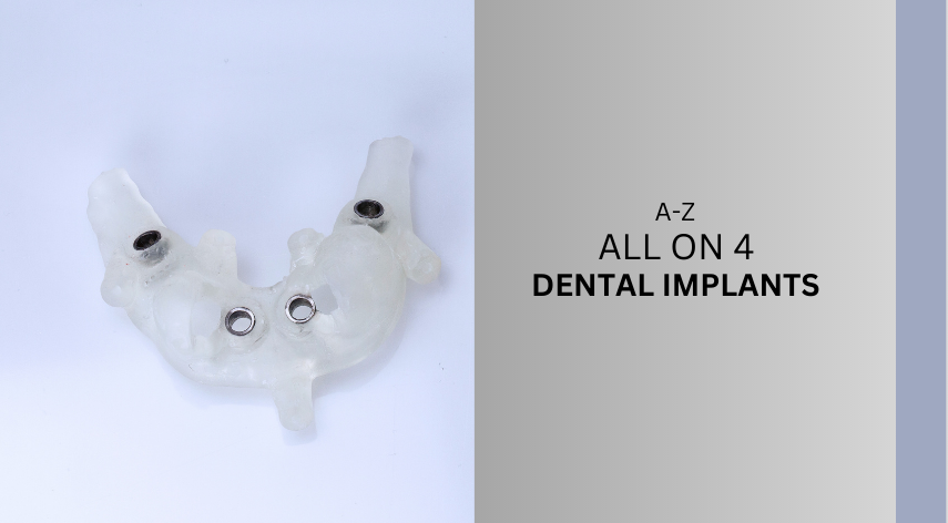 A To Z of All on Four Dental Implants