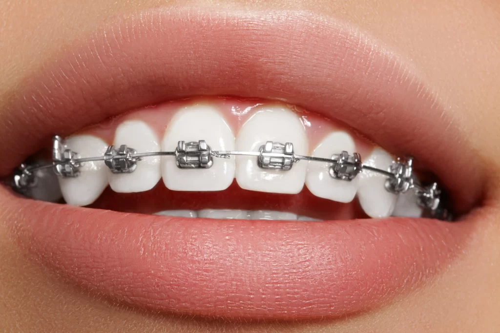 Best Orthodontist in Lahore