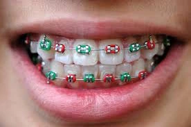 Best Orthodontist in Lahore