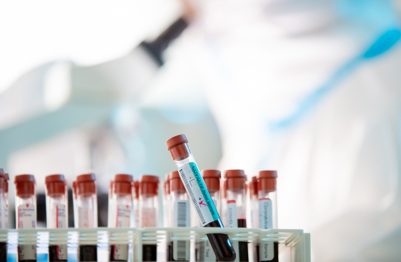 Top 10 Common Blood Tests and What They Reveal About Your Health Top 10 Common Blood Tests and What They Reveal About Your Health